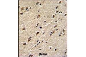 Formalin-fixed and paraffin-embedded human brain with DDX5 Antibody (Center), which was peroxidase-conjugated to the secondary antibody, followed by DAB staining. (DDX5 Antikörper  (AA 306-334))