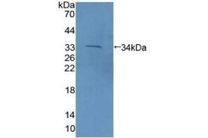 Detection of Recombinant PCDH15, Mouse using Polyclonal Antibody to Protocadherin 15 (PCDH15) (PCDH15 Antikörper  (AA 45-270))