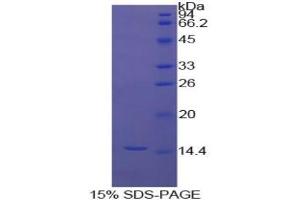 SDS-PAGE analysis of Cow Inhibin beta A Protein. (INHBA Protein)
