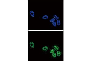 Confocal immunofluorescent analysis of PLA2G4A Antibody (Center) (ABIN652449 and ABIN2842304) with NCI- cell followed by Alexa Fluor? (PLA2G4A Antikörper  (AA 513-541))