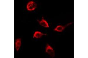 ABIN6268893 staining HepG2 by IF/ICC. (Integrin beta 4 Antikörper  (C-Term))