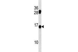 MDS1 antibody western blot analysis in mouse NIH3T3 lysate. (MECOM Antikörper  (AA 81-109))