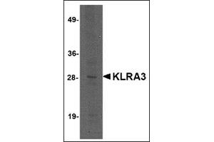 Western blot analysis of KLRA3 in mouse brain tissue lysate with this product at 2 μg/ml. (Klra3 Antikörper  (C-Term))