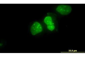 Immunofluorescence of monoclonal antibody to XRCC6 on HeLa cell. (XRCC6 Antikörper  (AA 1-609))