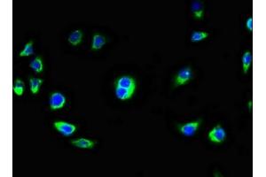 Immunofluorescence staining of A549 cells with ABIN7145860 at 1:100, counter-stained with DAPI. (KCTD7 Antikörper  (AA 5-152))