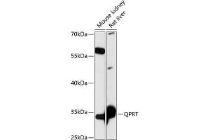 Western blot analysis of extracts of various cell lines, using QPRT antibody (ABIN7269781) at 1:3000 dilution. (QPRT Antikörper  (AA 1-297))