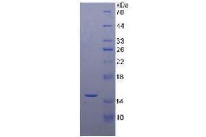 SDS-PAGE analysis of Human RNASEN Protein. (DROSHA Protein)