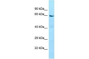WB Suggested Anti-STXBP4 Antibody Titration: 1.