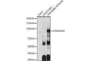Immunoprecipitation analysis of 600 μg extracts of Rat testis cells using 3 μg FB2 antibody (ABIN7267112). (FAM160B2 Antikörper)