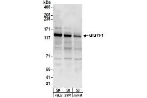 Western Blotting (WB) image for anti-GRB10 Interacting GYF Protein 1 (GIGYF1) (AA 350-400) antibody (ABIN7449741)