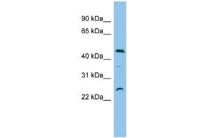 C1orf102 antibody used at 1 ug/ml to detect target protein. (OSCP1 Antikörper  (N-Term))