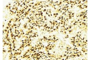 ABIN6277282 at 1/100 staining Human lung tissue by IHC-P. (PDCD4 Antikörper  (N-Term))