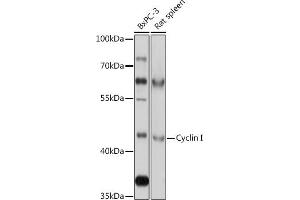 Western blot analysis of extracts of various cell lines, using Cyclin I antibody (ABIN7266570) at 1:1000 dilution. (Cyclin I Antikörper  (AA 257-377))