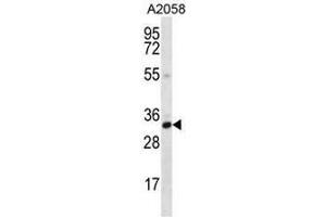 CNN2 Antibody (N-term) western blot analysis in A2058 cell line lysates (35µg/lane).