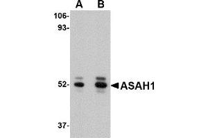 Western Blotting (WB) image for anti-N-Acylsphingosine Amidohydrolase (Acid Ceramidase) 1 (ASAH1) (C-Term) antibody (ABIN1030257) (ASAH1 Antikörper  (C-Term))