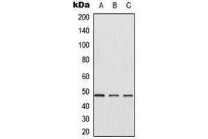Western blot analysis of CK1 gamma 1 expression in Jurkat (A), NIH3T3 (B), H9C2 (C) whole cell lysates.
