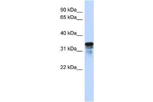 WB Suggested Anti-FAM82B Antibody Titration:  0. (FAM82B Antikörper  (N-Term))