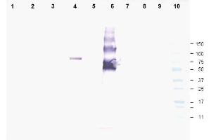 Image no. 1 for anti-Ankyrin Repeat Domain 26 (ANKRD26) (AA 1-15), (N-Term) antibody (ABIN401330) (ANKRD26 Antikörper  (N-Term))