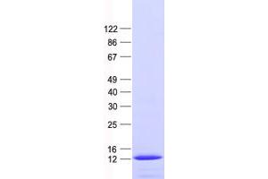 Western Blotting (WB) image for DNA Repair Protein RAD51 Homolog 3 (RAD51C) protein (His tag) (ABIN2730411)