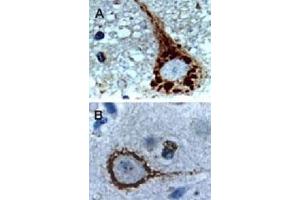 Formalin-fixed, paraffin-embedded dog brain sections stained for Active/Cleaved CASP9 expression using CASP9 polyclonal antibody  at 1 : 2000. (Caspase 9 Antikörper)