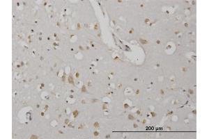 Immunoperoxidase of monoclonal antibody to CDKL2 on formalin-fixed paraffin-embedded human cerebral cortex. (CDKL2 Antikörper  (AA 394-493))