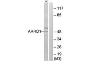 Western Blotting (WB) image for anti-Arrestin Domain Containing 1 (ARRDC1) (AA 167-216) antibody (ABIN2889863) (ARRDC1 Antikörper  (AA 167-216))