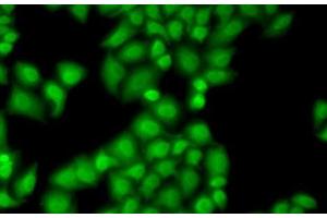 Immunofluorescence analysis of MCF7 cells using GTF2F1 Polyclonal Antibody