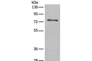 Western blot analysis of Human hepatocellular carcinoma 2 tissue lysate using ADGRE3 Polyclonal Antibody at dilution of 1:400 (EMR3 Antikörper)