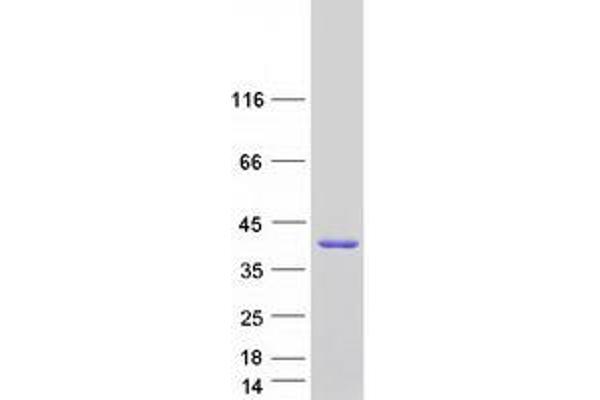 SULT1A4 Protein (Transcript Variant 2) (Myc-DYKDDDDK Tag)