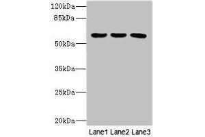 Western blot All lanes: PIK3R3 antibody at 3. (PIK3R3 Antikörper  (Regulatory Subunit Gamma))