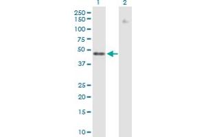 Western Blot analysis of ZNF776 expression in transfected 293T cell line by ZNF776 MaxPab polyclonal antibody. (ZNF776 Antikörper  (AA 1-476))