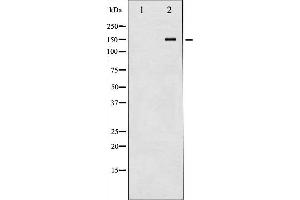 Western blot analysis of Met expression in HepG2 whole cell lysates,The lane on the left is treated with the antigen-specific peptide. (c-MET Antikörper  (C-Term))