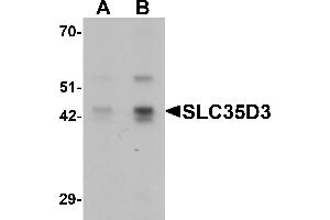 Western Blotting (WB) image for anti-Solute Carrier Family 35, Member D3 (SLC35D3) (C-Term) antibody (ABIN1077364) (SLC35D3 Antikörper  (C-Term))