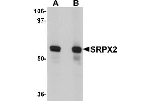 Western Blotting (WB) image for anti-Sushi-Repeat Containing Protein, X-Linked 2 (SRPX2) (N-Term) antibody (ABIN1031586) (SRPX2 Antikörper  (N-Term))