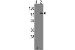 Image no. 2 for anti-Leo1, Paf1/RNA Polymerase II Complex Component, Homolog (S. Cerevisiae) (LEO1) (N-Term) antibody (ABIN357340)