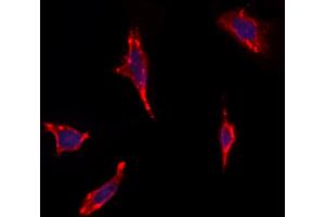 ABIN6263838 and ABIN6272757 staining Hela by IF/ICC.