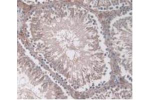 DAB staining on IHC-P; Samples: Rat Testis Tissue (ORM1 Antikörper  (AA 19-186))