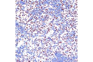 Immunohistochemistry of paraffin-embedded mouse spleen using PELP1 antibody (ABIN6130610, ABIN6145442, ABIN6145443 and ABIN6217403) at dilution of 1:100 (40x lens). (PELP1 Antikörper)