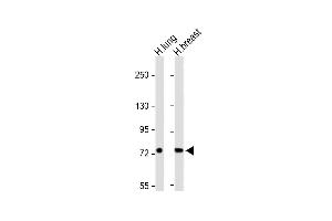Western Blotting (WB) image for anti-Solute Carrier Family 6 (Amino Acid Transporter), Member 14 (Slc6a14) (AA 602-631), (C-Term) antibody (ABIN656900)