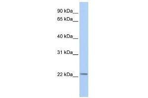 HIST1H1T antibody used at 1 ug/ml to detect target protein.