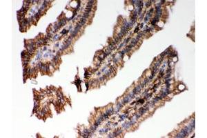 IHC testing of FFPE mouse intestine with HLA-C antibody. (HLA-C Antikörper)