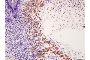 Immunohistochemistry (IHC) image for anti-Myosin Light Chain 6, Alkali, Smooth Muscle and Non Muscle (MYL6) (pSer30), (pTyr29) antibody (ABIN710156)