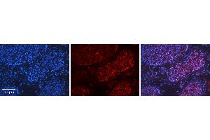 Immunohistochemistry (IHC) image for anti-Histone Deacetylase 2 (HDAC2) (Middle Region) antibody (ABIN2777505)