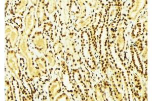 ABIN6269069 at 1/100 staining Mouse kidney tissue by IHC-P.