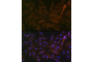 Immunofluorescence analysis of U-2 OS cells using PP2A alpha + beta Rabbit mAb (ABIN7269686) at dilution of 1:100 (40x lens). (PPP2CB Antikörper)