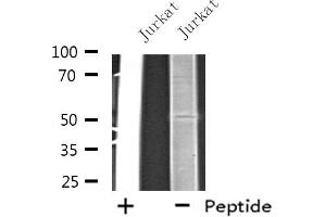 Western blot analysis of extracts from Jurkat cells, using EIF2B3 antibody. (EIF2B3 Antikörper  (Internal Region))
