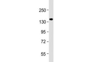 Western blot testing of human MCF-7 cell lysate with GIGYF2 antibody at 1:1000. (GIGYF2 Antikörper  (AA 835-869))