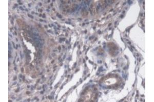 IHC-P analysis of Mouse Uterus Tissue, with DAB staining. (PPID Antikörper  (AA 9-189))