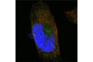 Confocal immunofluorescence analysis of PANC-1 cells using SORL1 mouse mAb (green). (SORL1 Antikörper)