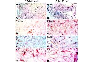 Immunohistochemistry of C5-d and C5-s mice with EAE. (Meerschweinchen Spinal Cord)
